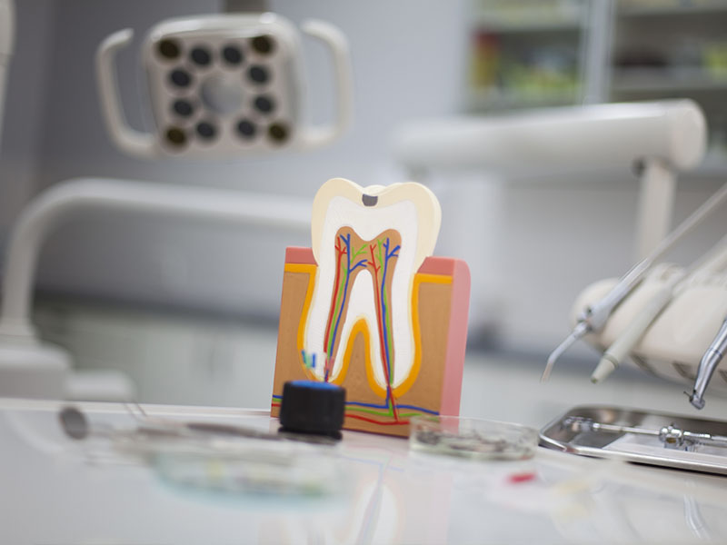 Davenport Dental Associates | Root Canals, TMJ Disorders and Night Guards